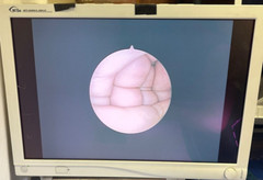 Stryker 502-904-030 4mm x 30° x 140mm Ideal Eyes Autoclavable Video Arthroscope