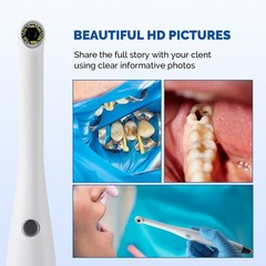 Dental HD 720P Intraoral Camera USB Type Imaging Intra Oral Endoscope 6 LEDS
