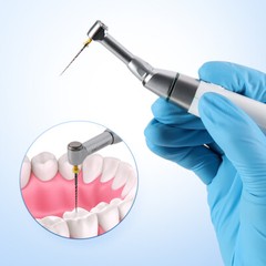 2 in 1 Dental Wireless Endo Motor with Apex Locator Root Canal Treatment