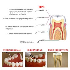 LED Ultrasonic Scaler Scaling Perio Endo Handpiece+Tips Dental