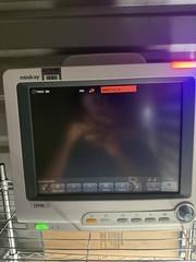 Mindray DPM6 Patient Monitor
