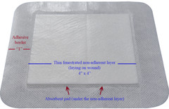 Areza Island Wound Dressing (Bordered Gauze) 6″ x 6″ Sterile (30 Per Box)