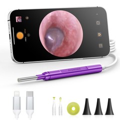 AnyScope Digital Otoscope Compatible with iPhone and Android Devices, Purple